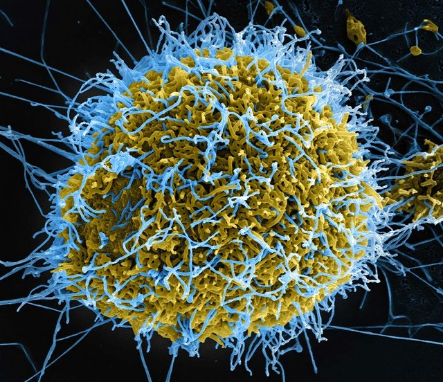 Ebola: Peste 900 de cazuri suspecte, identificate în RD Congo, anunţă şeful OMS