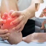 5 semne că ai inflamație cronică și ce analize confirmă