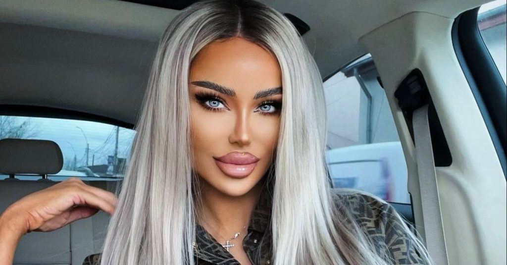 Bianca Drăgușanu s-a operat din nou. Vedeta a apărut cu capul bandajat: „Am făcut-o și pe asta!”