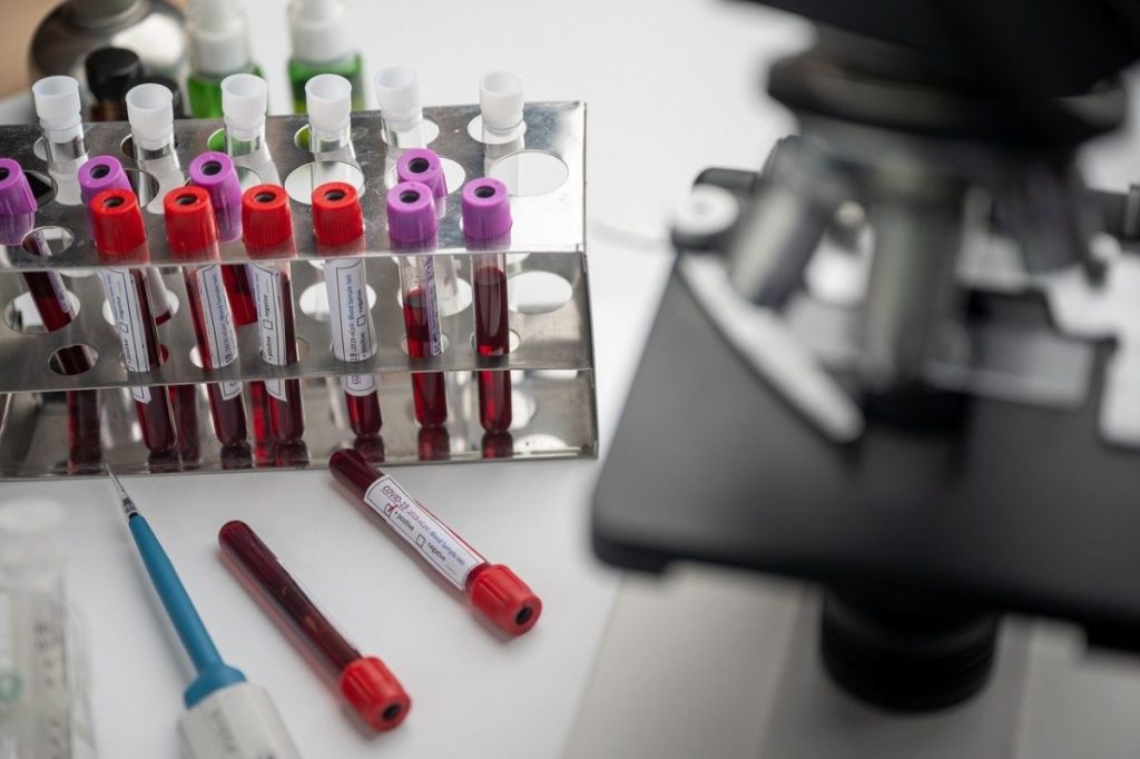 Un test de sânge ar putea prezice dacă adulții sănătoși sunt predispuși la Alzheimer