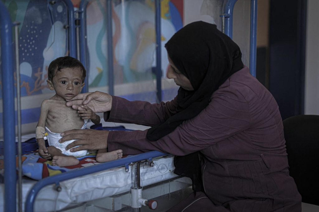 Tot mai mulți copii din Afganistan mor, pe măsură ce în țară ajung un număr redus de alimente, avertizează ONU