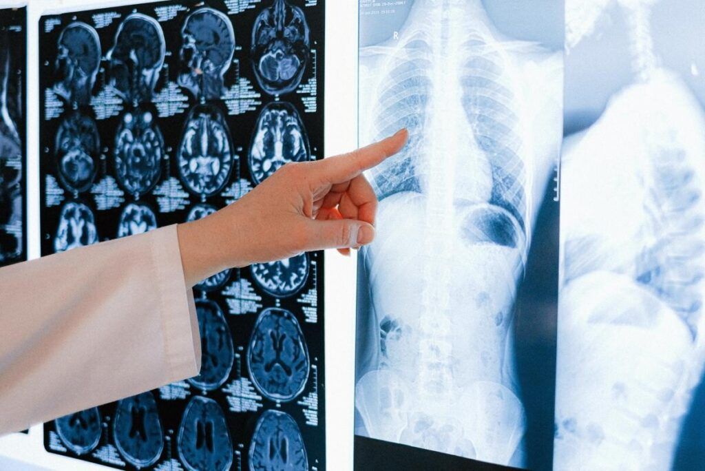 Atenționare pentru cei care au trecut de 60 de ani. Un medic avertizează: Atunci sunt diagnosticate frecvent multe boli grave