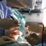 Colecistectomia, cel mai sigur tratament al litiazei biliare. Chirurg: “Pietrele sunt periculoase, indiferent de mărimea lor”
