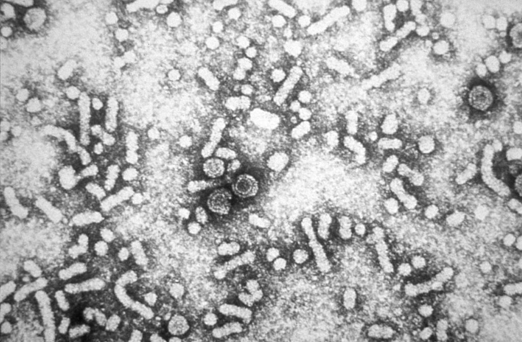 Un tratament experimental pentru hepatita B ar putea opri virusul în celulele ficatului. A intrat în testare la oameni