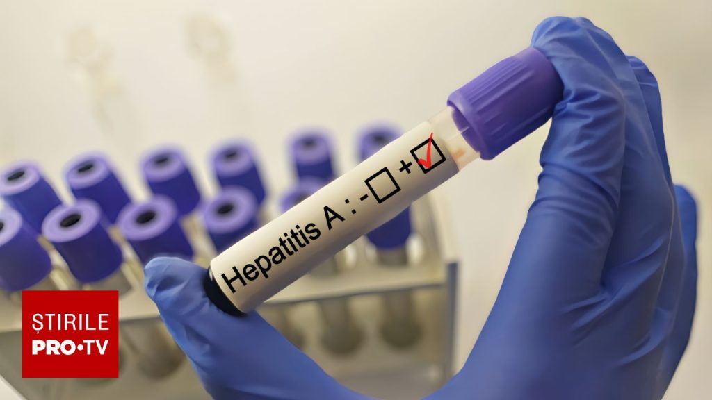 Focare de hepatită A în mai multe localități din Brașov. 85 de cazuri au fost raportate de la începutul anului școlar