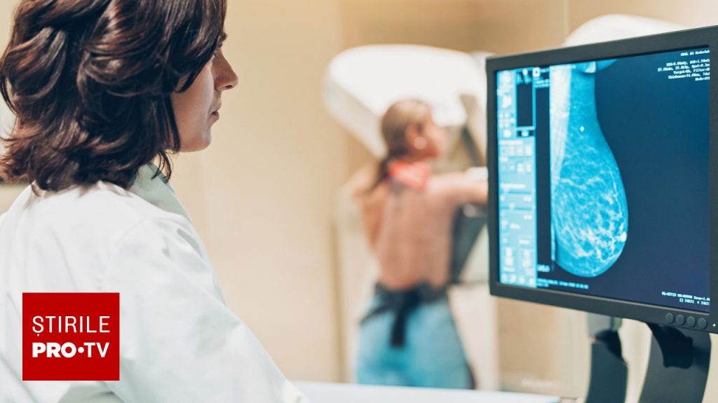 Cancerul de sân poate apărea și la 20 de ani. Medicii explică de ce controalele periodice sunt esențiale