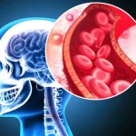 Dr. Bogdan Dorobăţ: Plata în momentul de faţă este foarte tristă, ca să zic aşa, foarte puţin motivantă/ Undeva în jur de 100 de lei pentru intervenţie cerebrală la care foloseşti materiale de 1.000 de euro