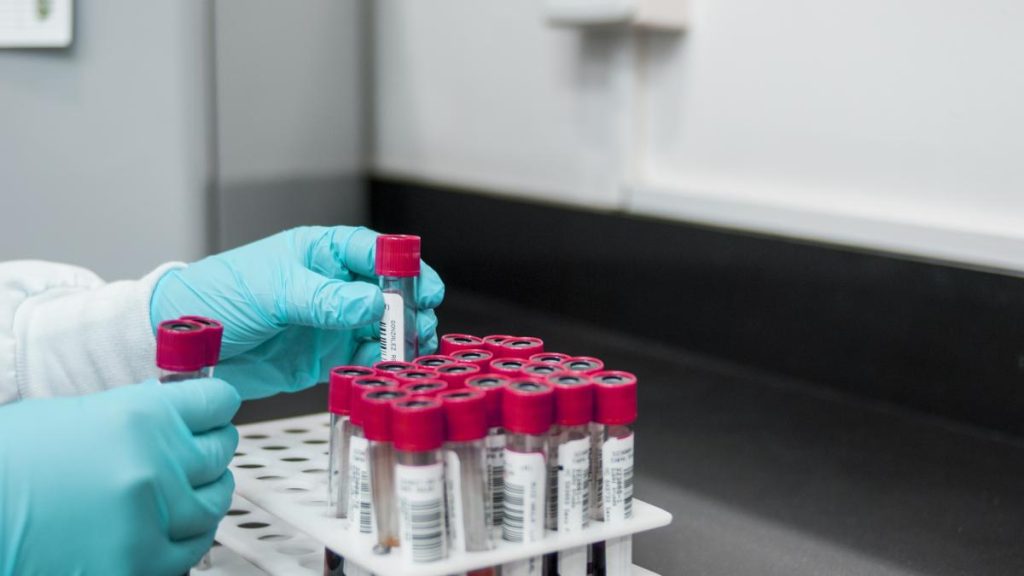 Pacienţii cu boli cardiovasculare, cerebrovasculare, neurologice, renale, diabet, investigații decontate