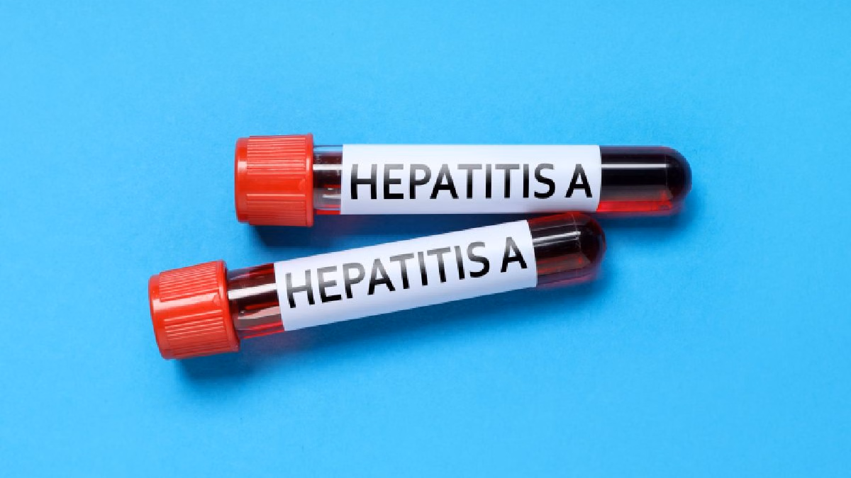 Hepatita A, în atenția DSP Gorj